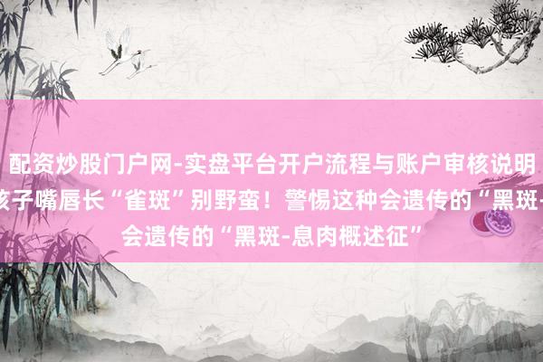 配资炒股门户网-实盘平台开户流程与账户审核说明 【生僻病】孩子嘴唇长“雀斑”别野蛮！警惕这种会遗传的“黑斑‑息肉概述征”